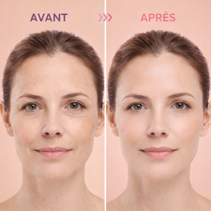 Glow Lift Pro+