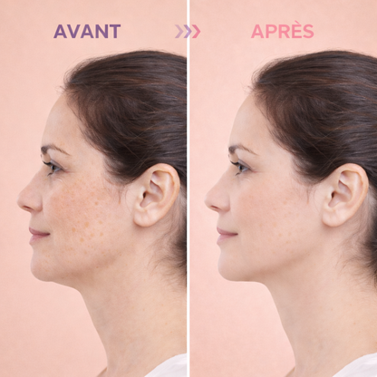 Glow Lift Pro+